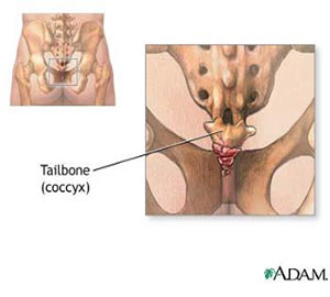 tailbone-pain